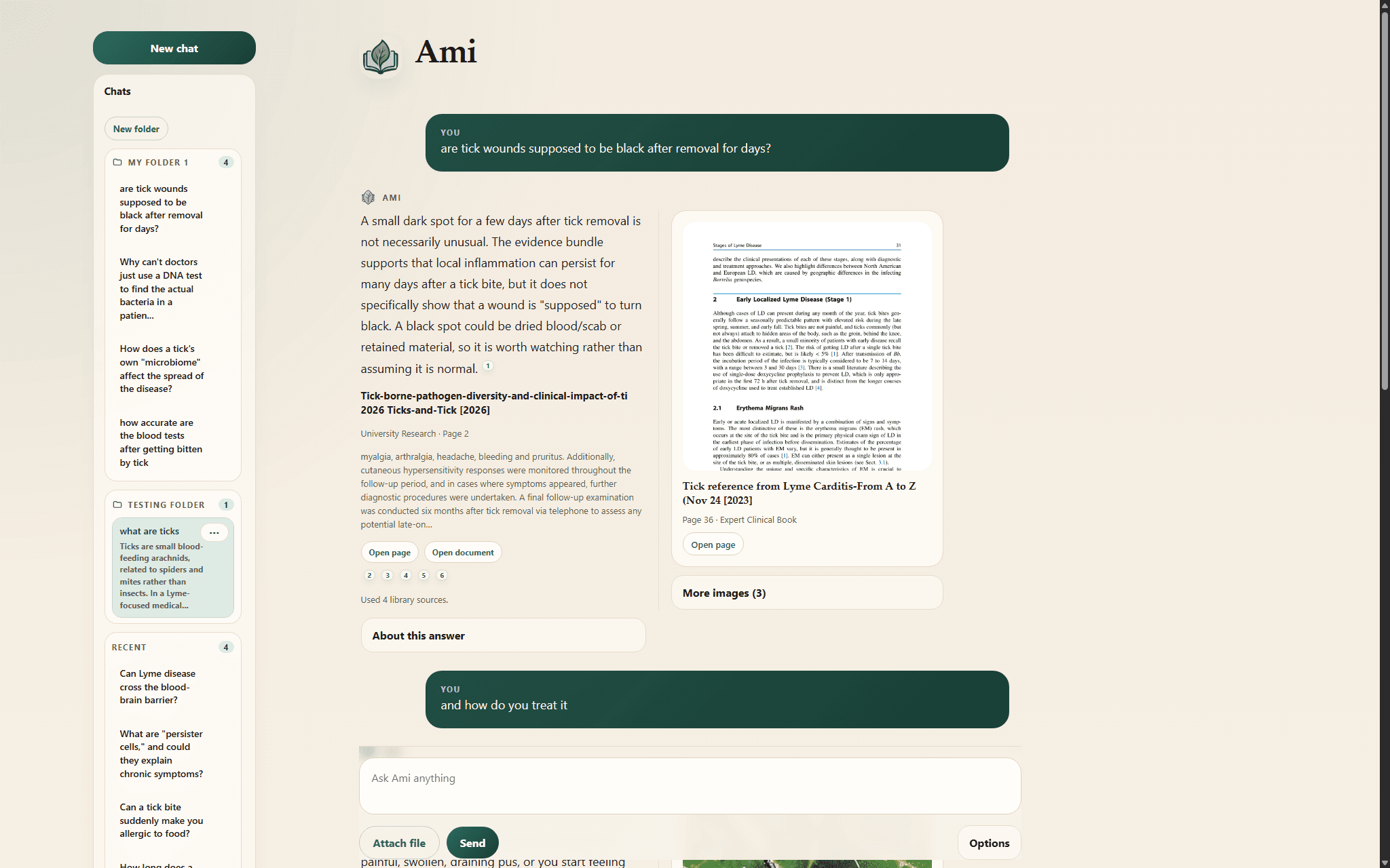 Ami interface with saved chats, grounded answer text, and an evidence preview card
